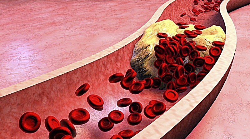 A importância da levedura do arroz vermelho no combate ao colesterol.